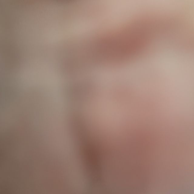 슈퍼달마시안